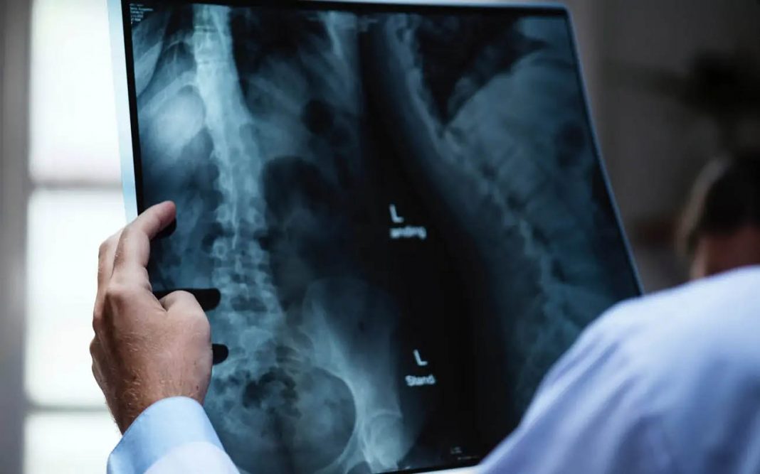 Respiratory disease Mesothelioma and other respiratory diseases