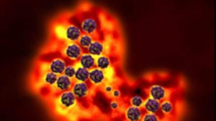 Hundreds of cases of highly contagious Norovirus reported across Spain