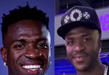 Vinicius Goes Under the Knife as Fans Spot a New Look Real Madrid star Vinicius Jr has been making use of his summer break in a way most footballers do: relaxing, posting on Instagram and, apparently, fitting in a little facial fine-tuning before pre-season calls him back.
